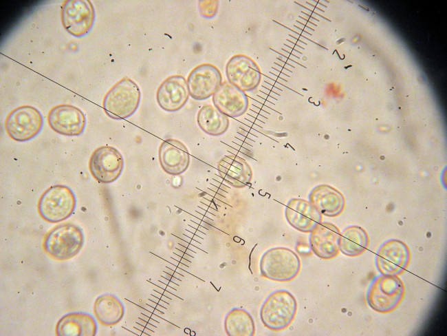 Pluteus secc. Hispidoderma (cfr. P. semibulbosus)